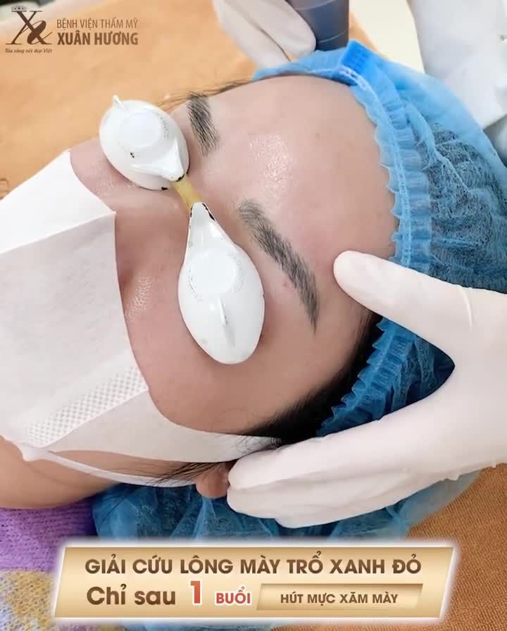 XÓA MỰC ĐIÊU KHẮC MÀY BỊ TRỔ XANH CHỈ TRONG "NHÁY MẮT"
